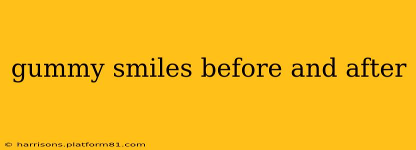 gummy smiles before and after