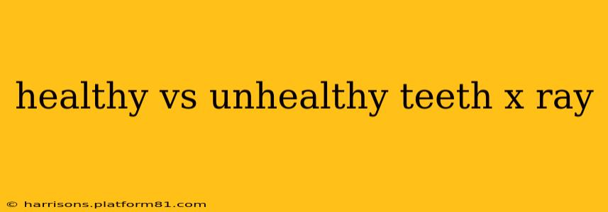 healthy vs unhealthy teeth x ray
