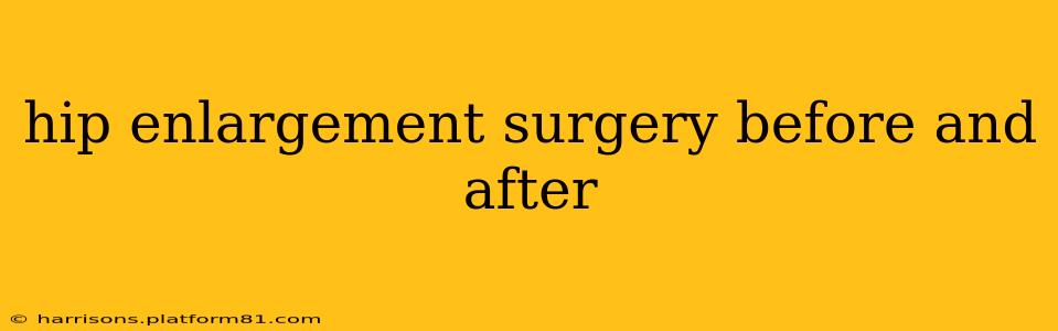 hip enlargement surgery before and after
