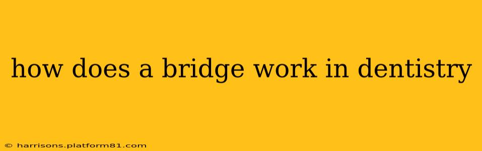 how does a bridge work in dentistry