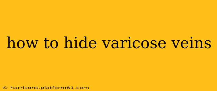 how to hide varicose veins