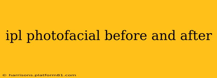 ipl photofacial before and after