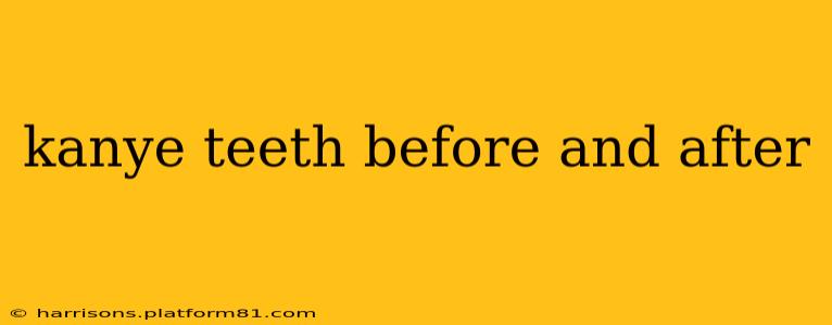 kanye teeth before and after
