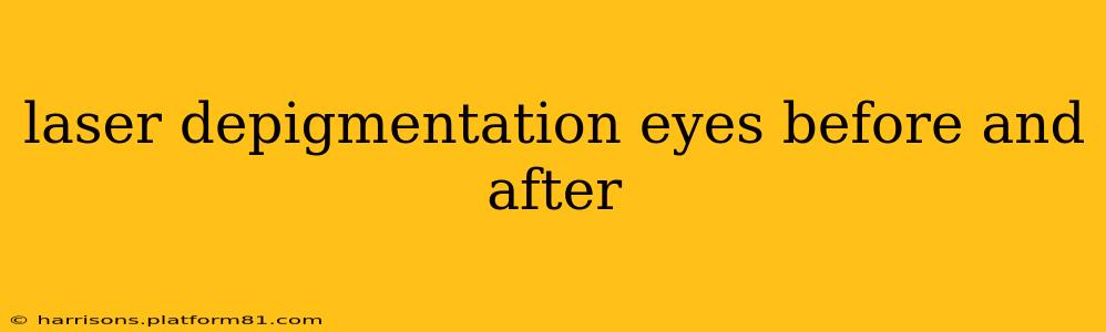 laser depigmentation eyes before and after