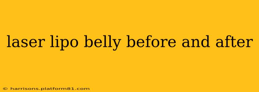 laser lipo belly before and after