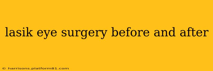 lasik eye surgery before and after