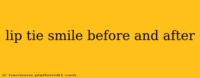 lip tie smile before and after