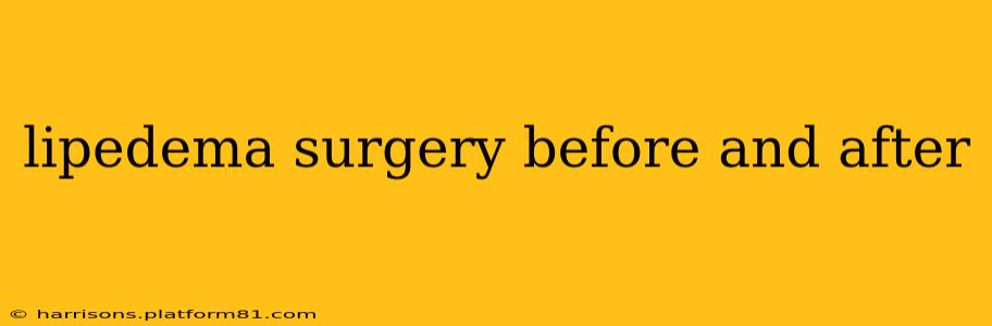 lipedema surgery before and after