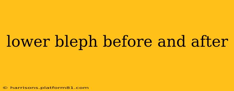 lower bleph before and after