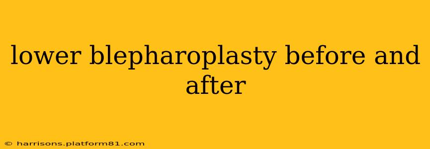 lower blepharoplasty before and after