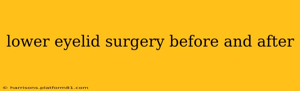 lower eyelid surgery before and after