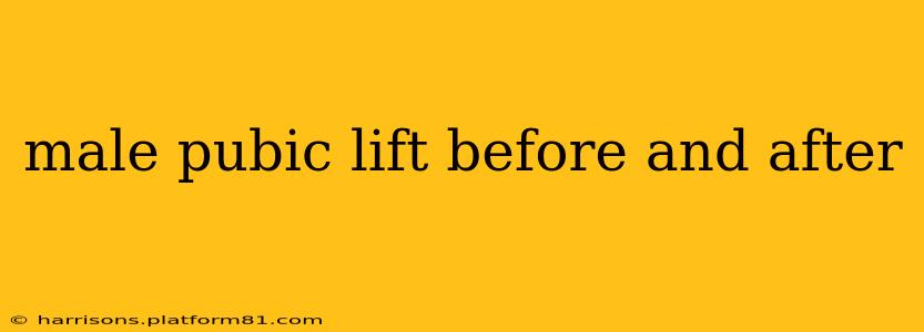 male pubic lift before and after