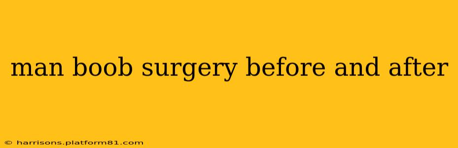 man boob surgery before and after