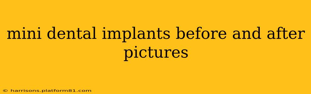 mini dental implants before and after pictures