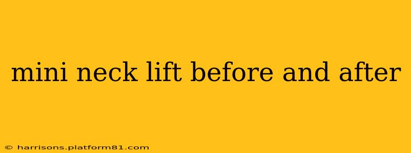mini neck lift before and after