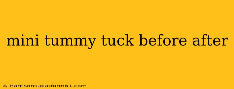 mini tummy tuck before after