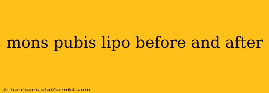 mons pubis lipo before and after