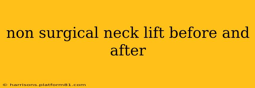 non surgical neck lift before and after
