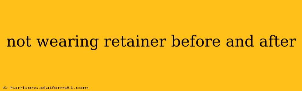 not wearing retainer before and after