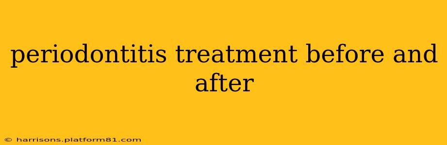 periodontitis treatment before and after