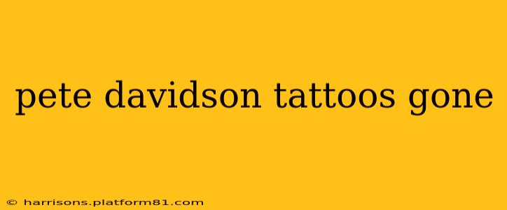 pete davidson tattoos gone