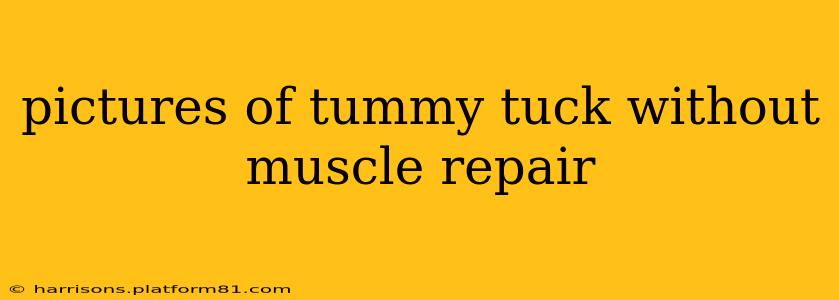 pictures of tummy tuck without muscle repair