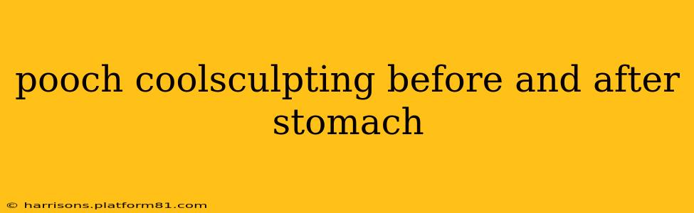 pooch coolsculpting before and after stomach