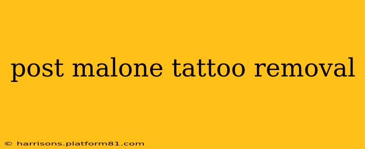 post malone tattoo removal