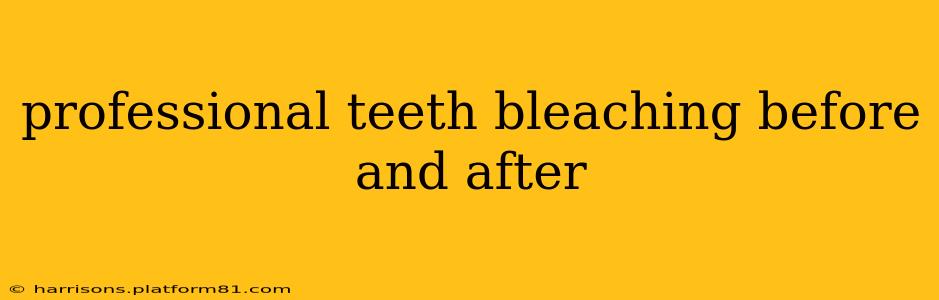 professional teeth bleaching before and after