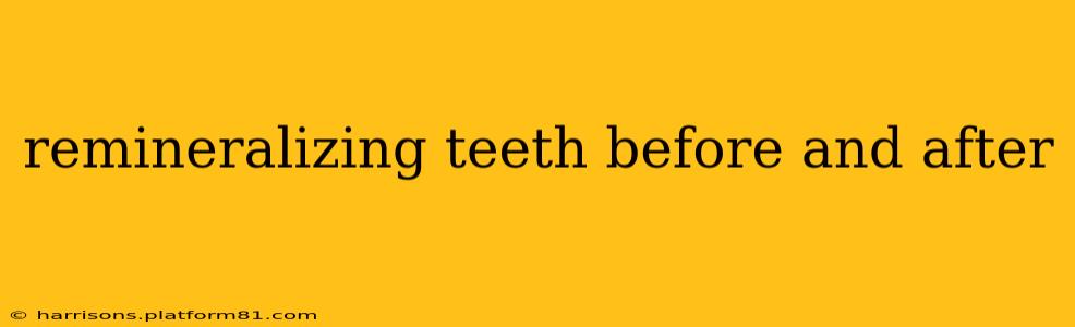 remineralizing teeth before and after