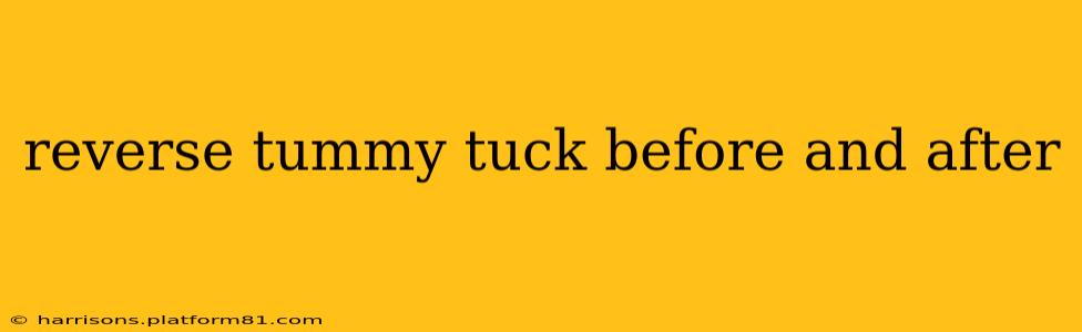 reverse tummy tuck before and after