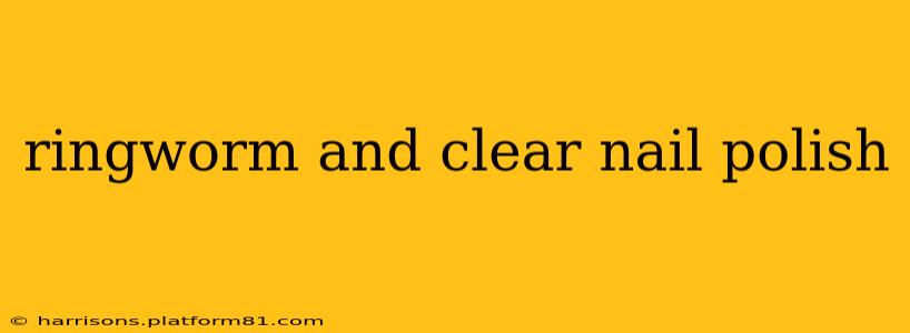 ringworm and clear nail polish