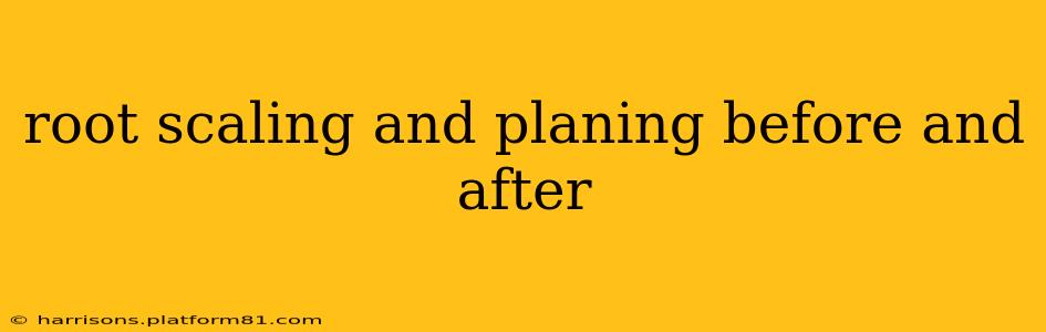 root scaling and planing before and after