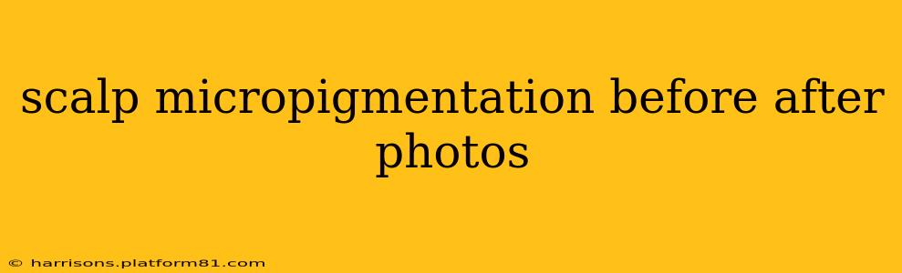 scalp micropigmentation before after photos