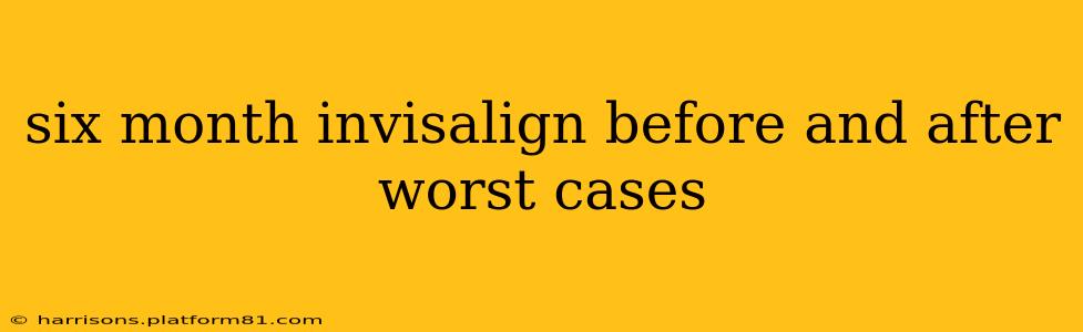 six month invisalign before and after worst cases