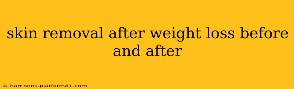 skin removal after weight loss before and after