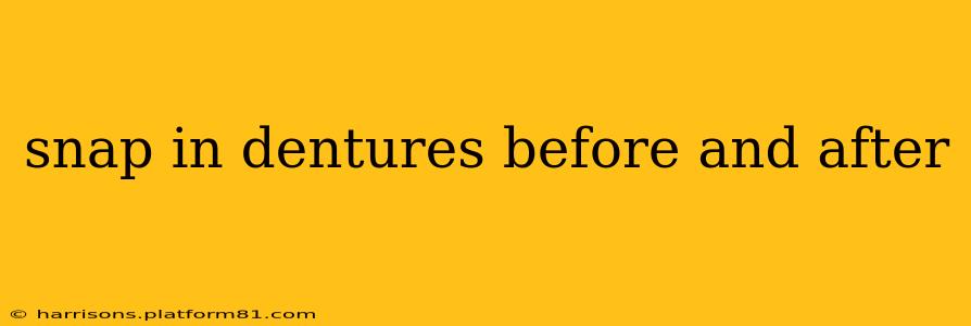 snap in dentures before and after