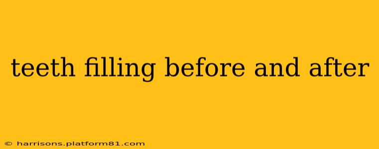 teeth filling before and after