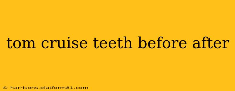 tom cruise teeth before after