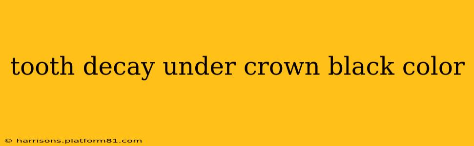 tooth decay under crown black color