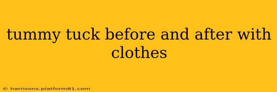 tummy tuck before and after with clothes
