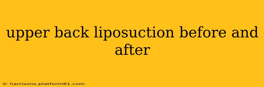 upper back liposuction before and after