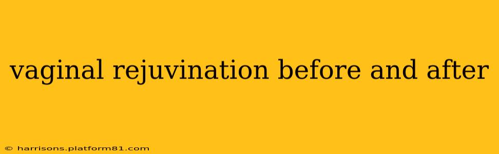 vaginal rejuvination before and after