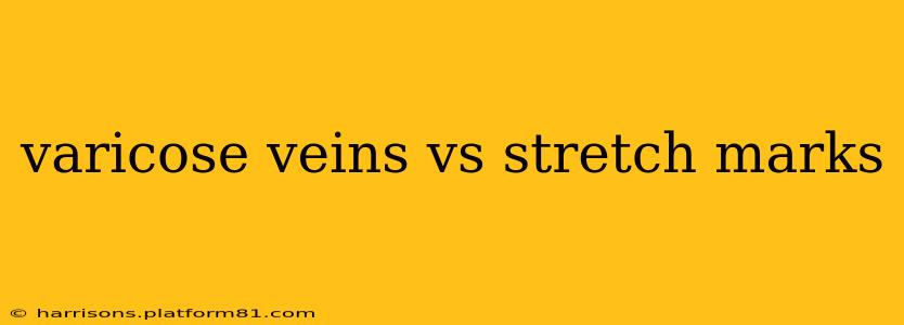 varicose veins vs stretch marks