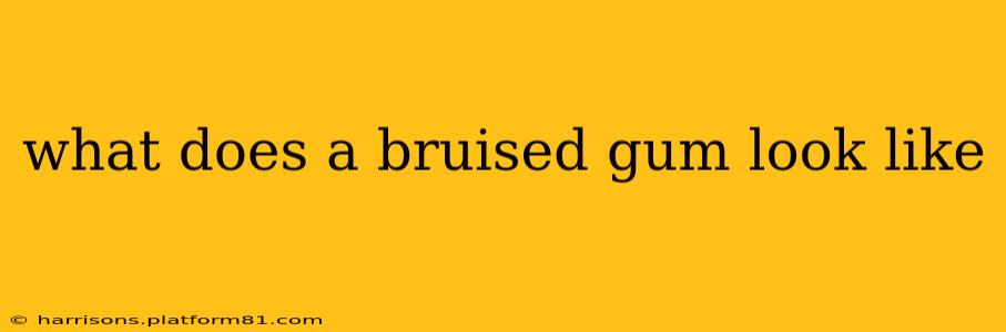 what does a bruised gum look like
