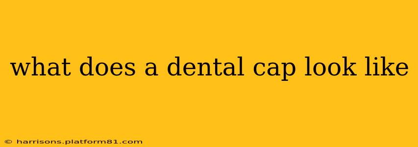 what does a dental cap look like