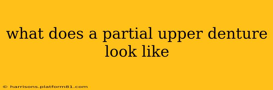what does a partial upper denture look like