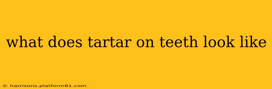 what does tartar on teeth look like