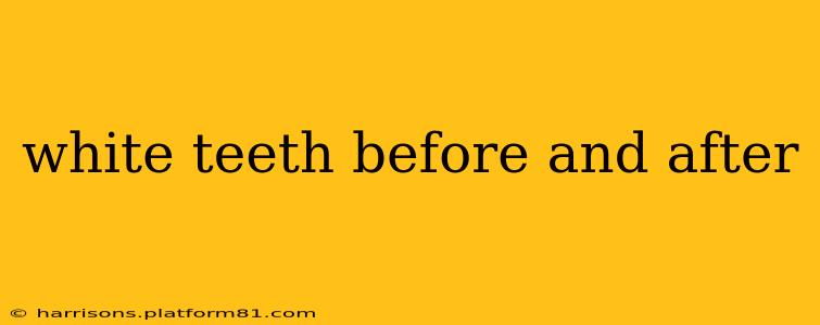 white teeth before and after