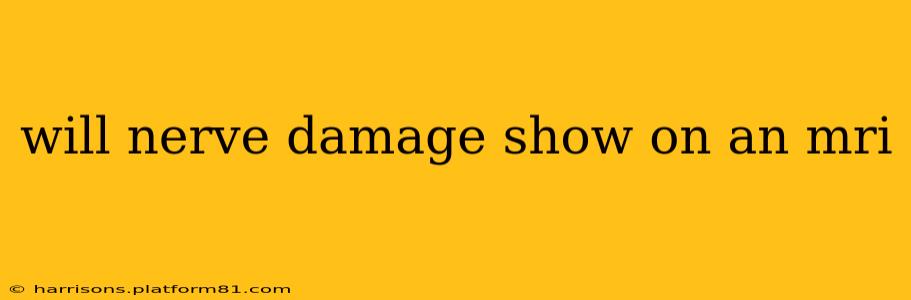 will nerve damage show on an mri